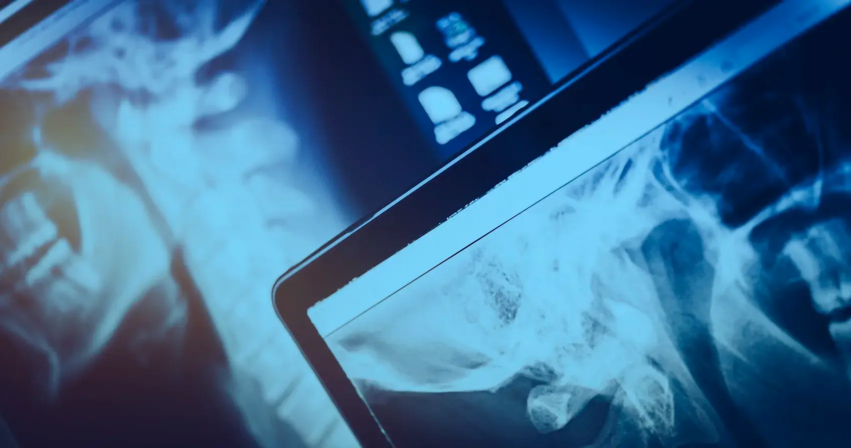 Sala de imagenología Hospital MQA - Resonancia magnética y tomografía avanzada en Guadalajara